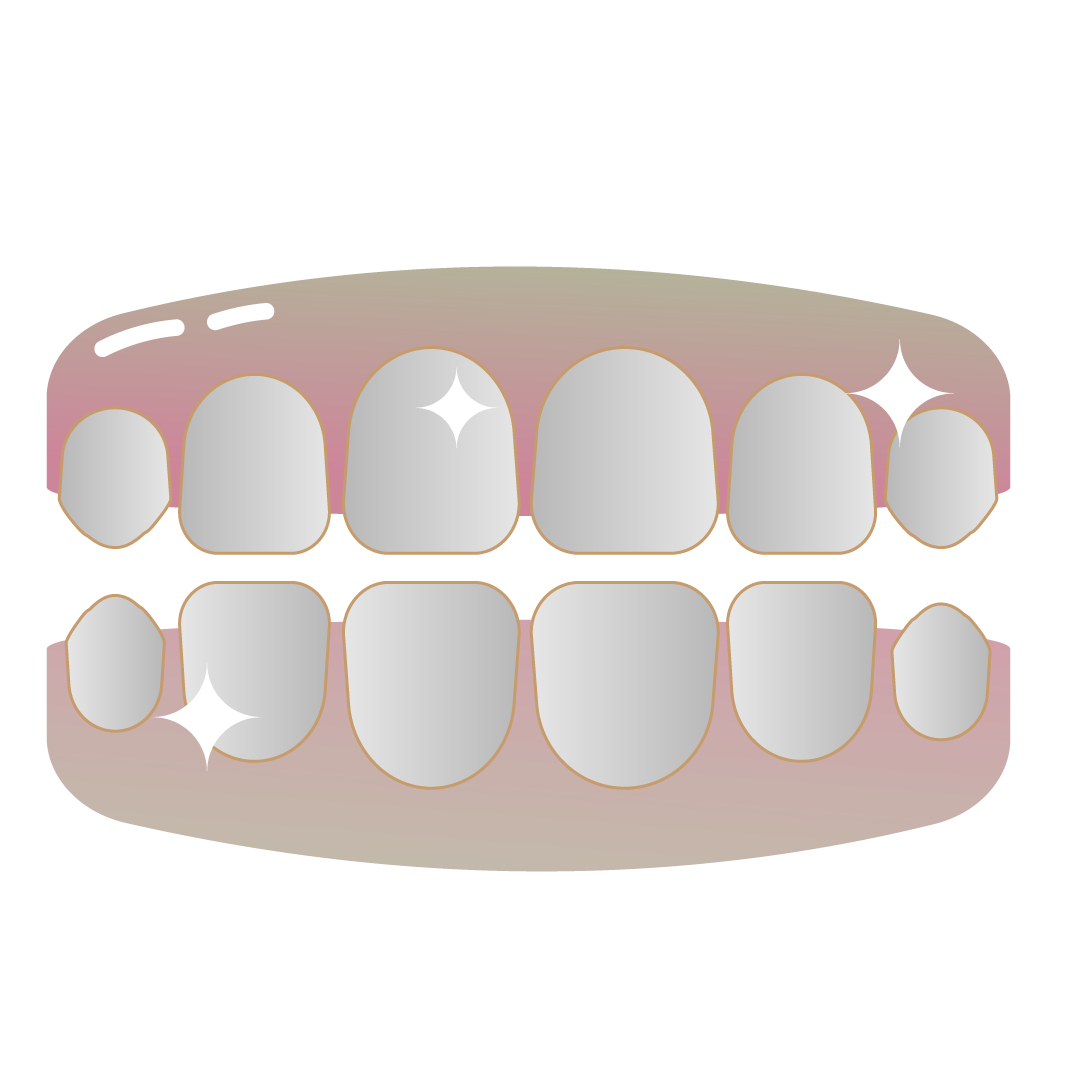 Dentes separados